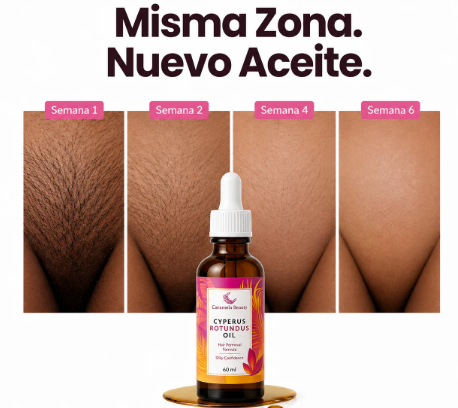 CYPERUS ROTUNDUS 60 ML | TRATAMIENTO NATURAL PARA DEBILITAR EL VELLO
